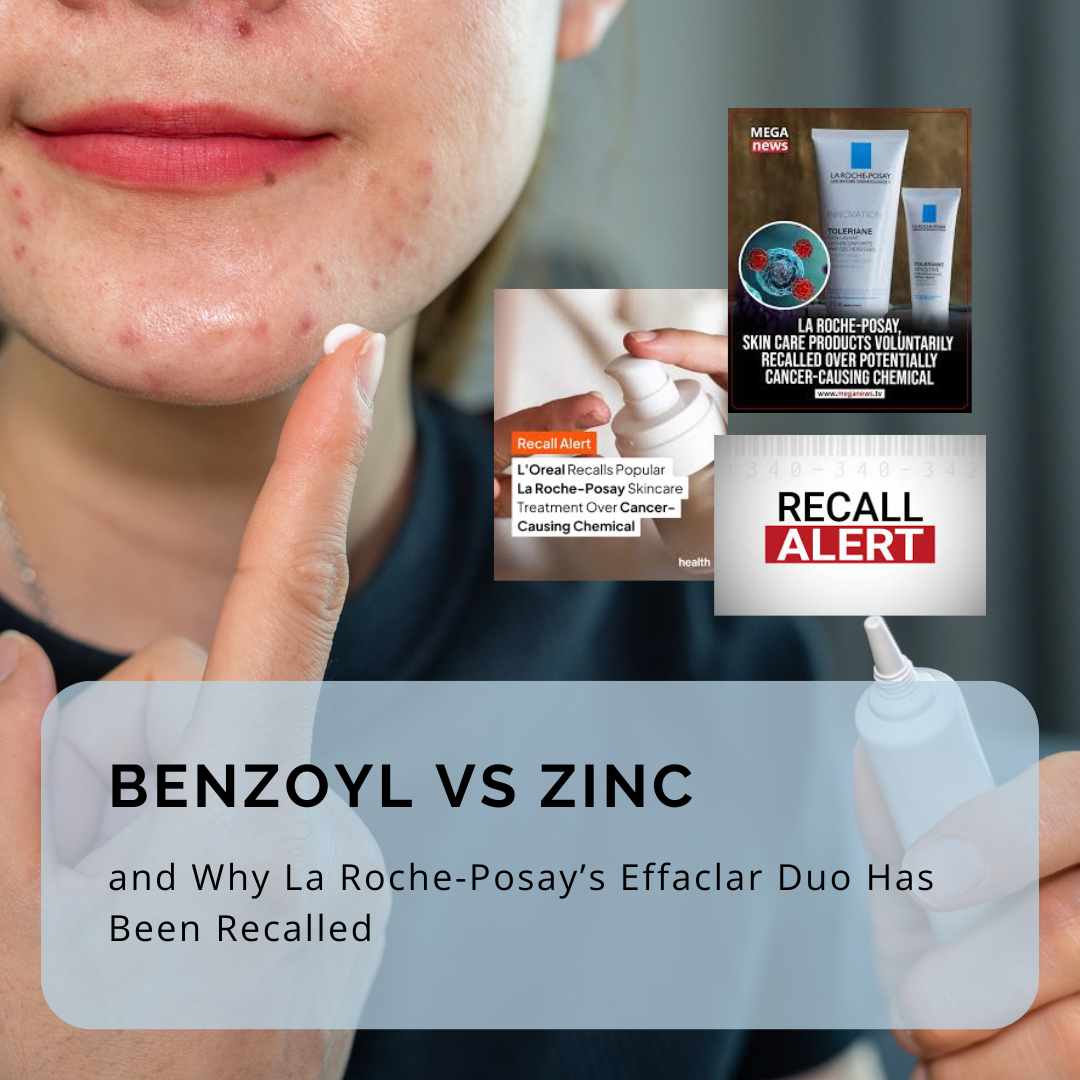 Benzoyl Vs Zinc and Why La Roche-Posay’s Effaclar Duo Has Been Recalled