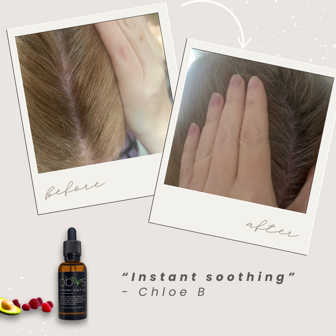 Organic Scalp Oil – Nourishing formula for hair growth, soothing sensitive scalps, and reducing dryness with natural, fragrance-free ingredients.