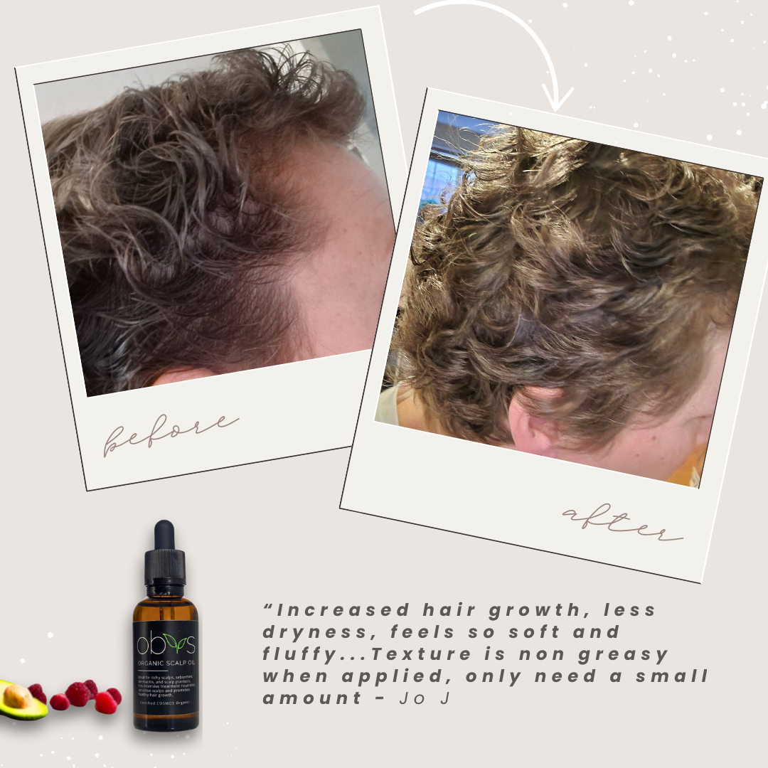 Organic Scalp Oil – Nourishing formula for hair growth, soothing sensitive scalps, and reducing dryness with natural, fragrance-free ingredients.