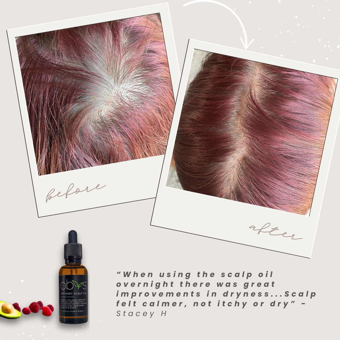 Organic Scalp Oil – Nourishing formula for hair growth, soothing sensitive scalps, and reducing dryness with natural, fragrance-free ingredients.