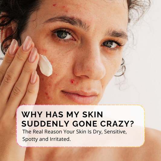 Millennial woman with adult acne and sensitive skin, looking at her face in a mirror as part of her skincare routine.