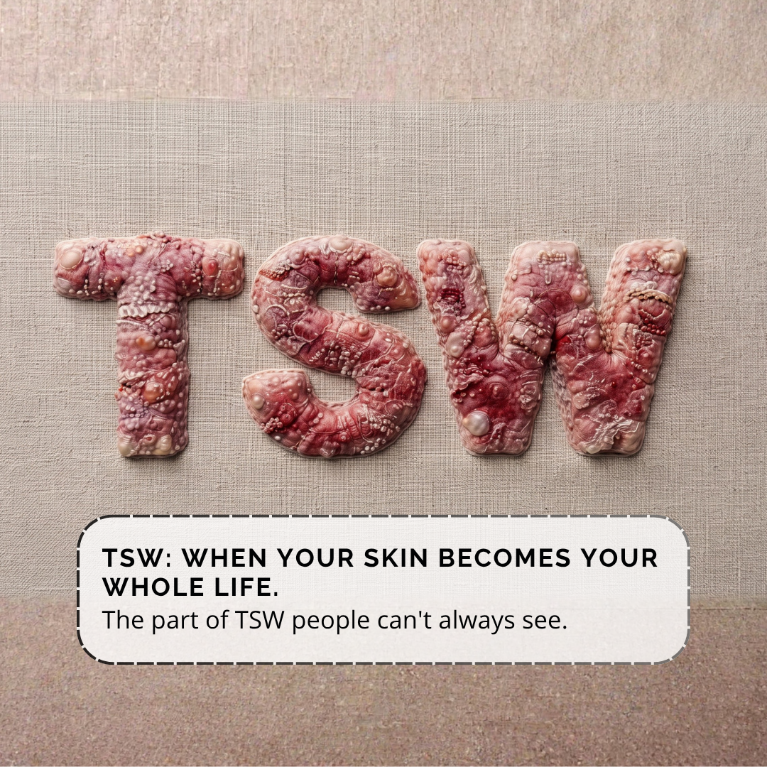 TSW: When Your Skin Becomes Your Whole Life