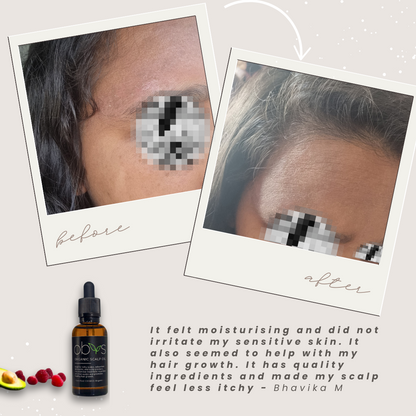 Organic Scalp Oil – Nourishing formula for hair growth, soothing sensitive scalps, and reducing dryness with natural, fragrance-free ingredients.
