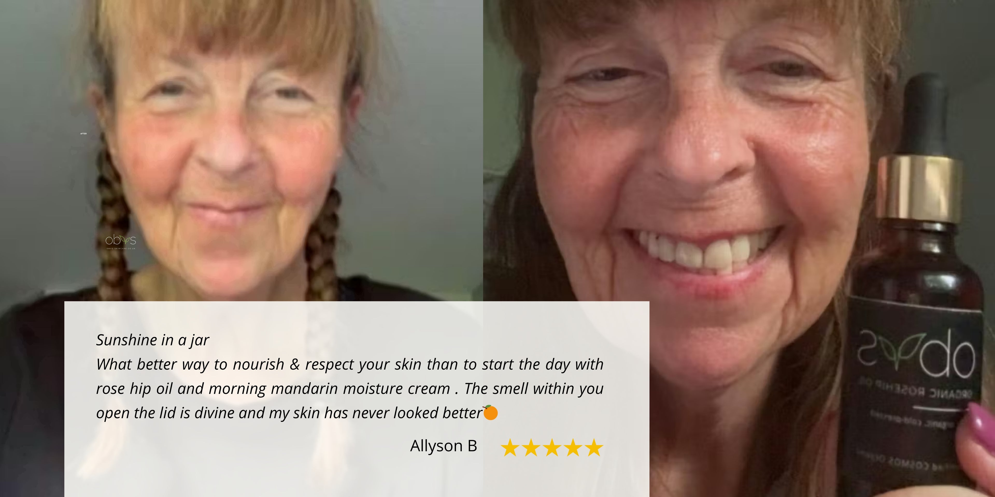 Close-up of mature skin with a radiant, dewy finish after applying Rosehip Oil. The skin appears hydrated and smooth, highlighting a natural youthful glow and reduced fine lines.